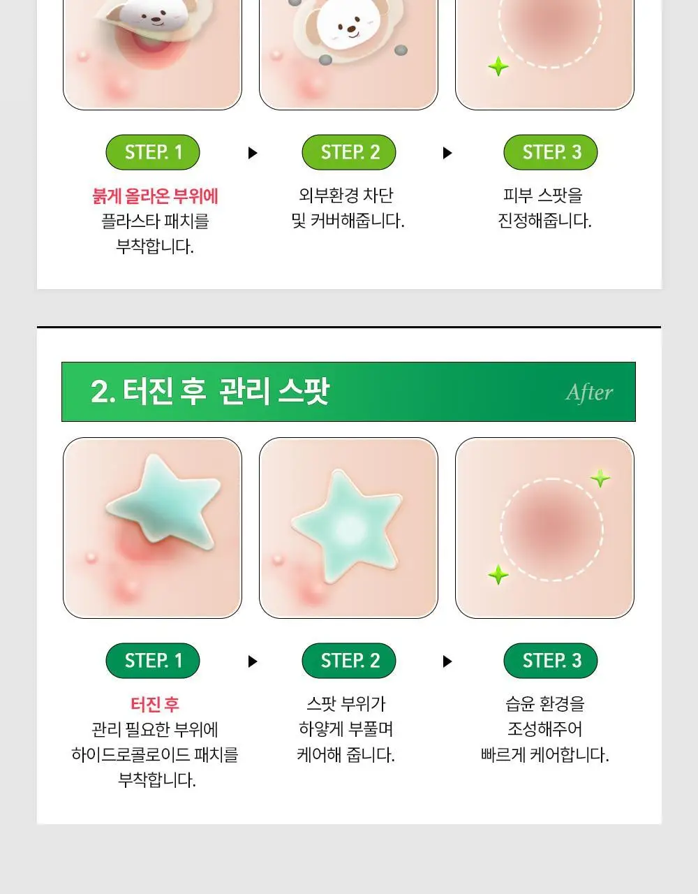 [라이즈 PICK] 유이크 바이옴 레미디 카밍 스팟 패치 2종 택 1 (단품/기획) 상세페이지 24